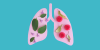 Medical English with TED: what you need to know about pneumonia